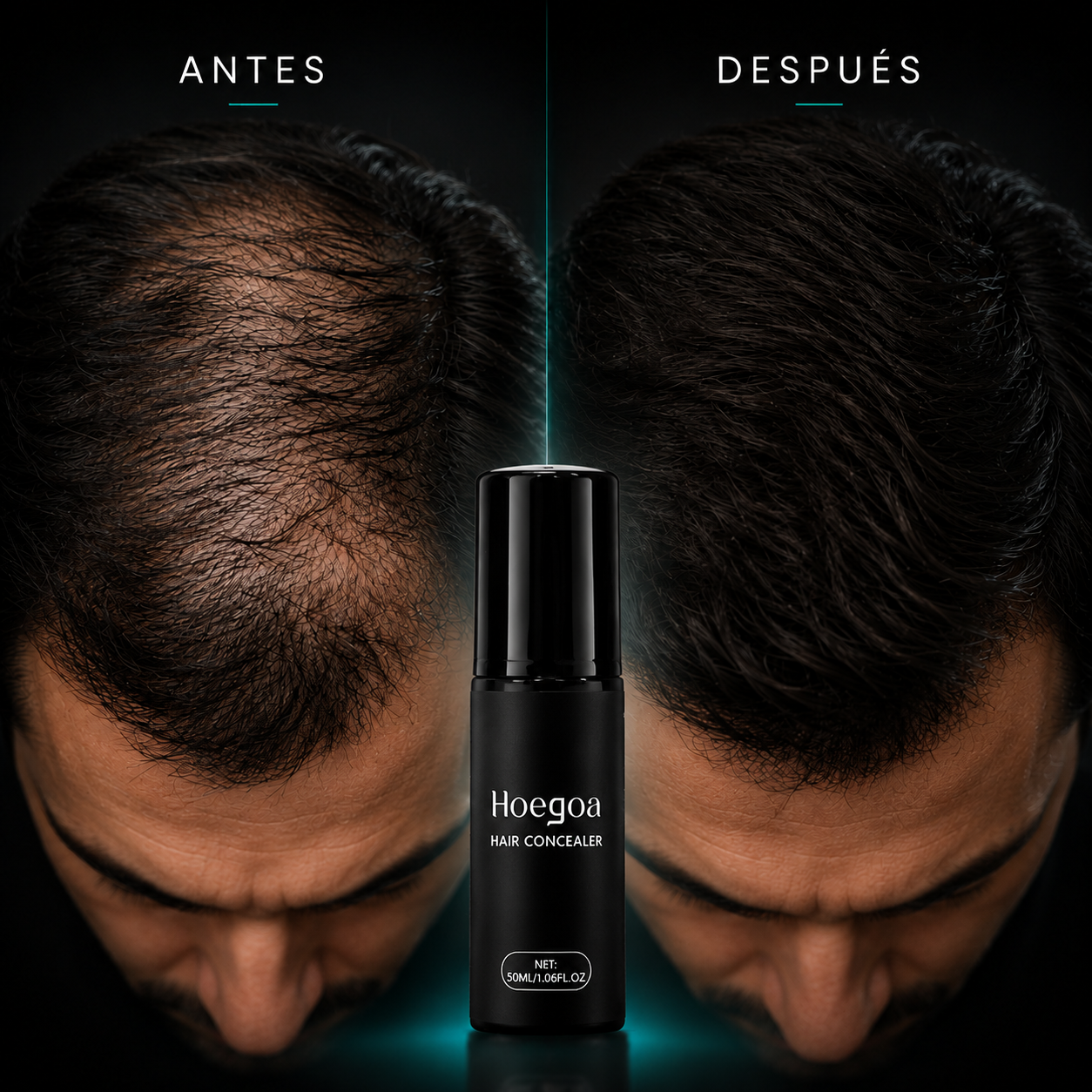 Disimula la calvicie en segundos con HOEGOA™ Corrector Capilar en Crema.