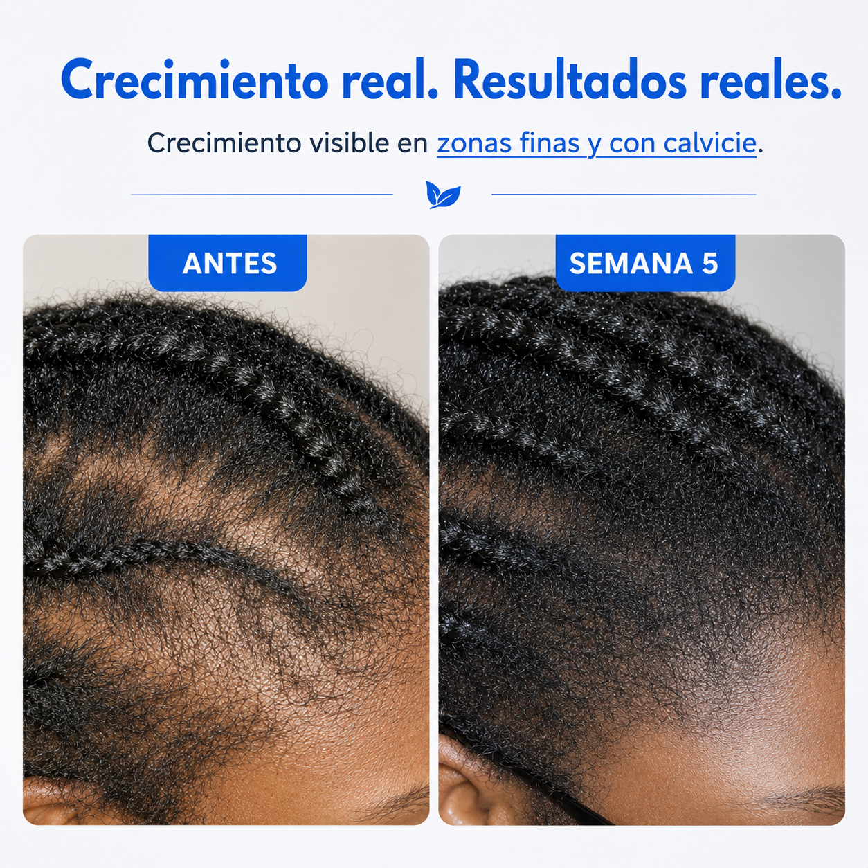 Sérum Capilar con Aplicador de Precisión.