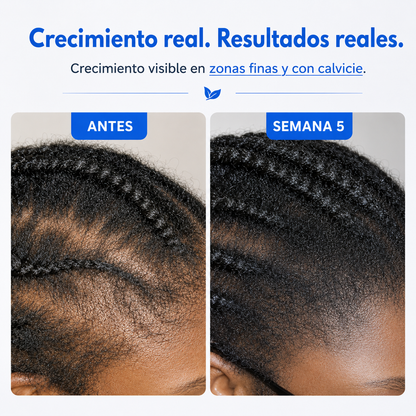 Sérum Capilar con Aplicador de Precisión.